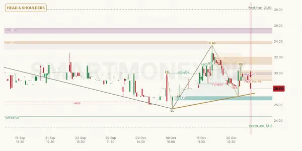 RUPL chart