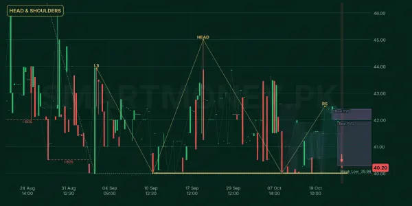 FRSM chart