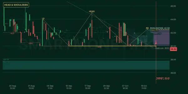 FRSM chart
