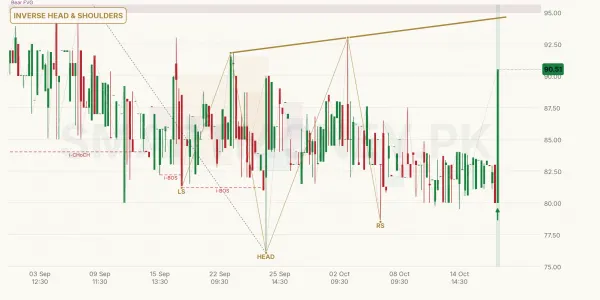 SZTM chart