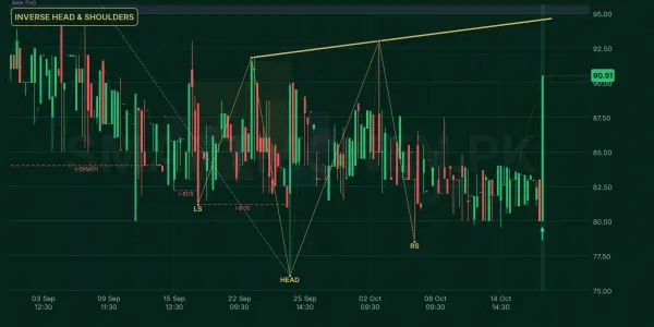 SZTM chart
