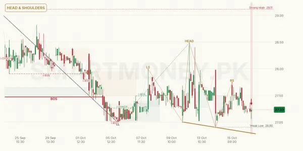 AVN chart