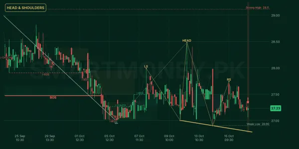 AVN chart