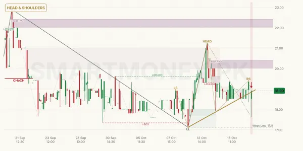 FECM chart